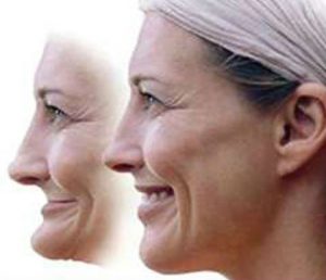 Facial Collapse illustration